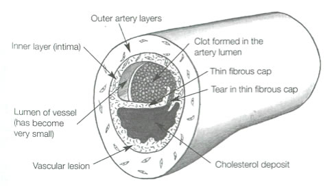 Vascular disease introduction graph 6